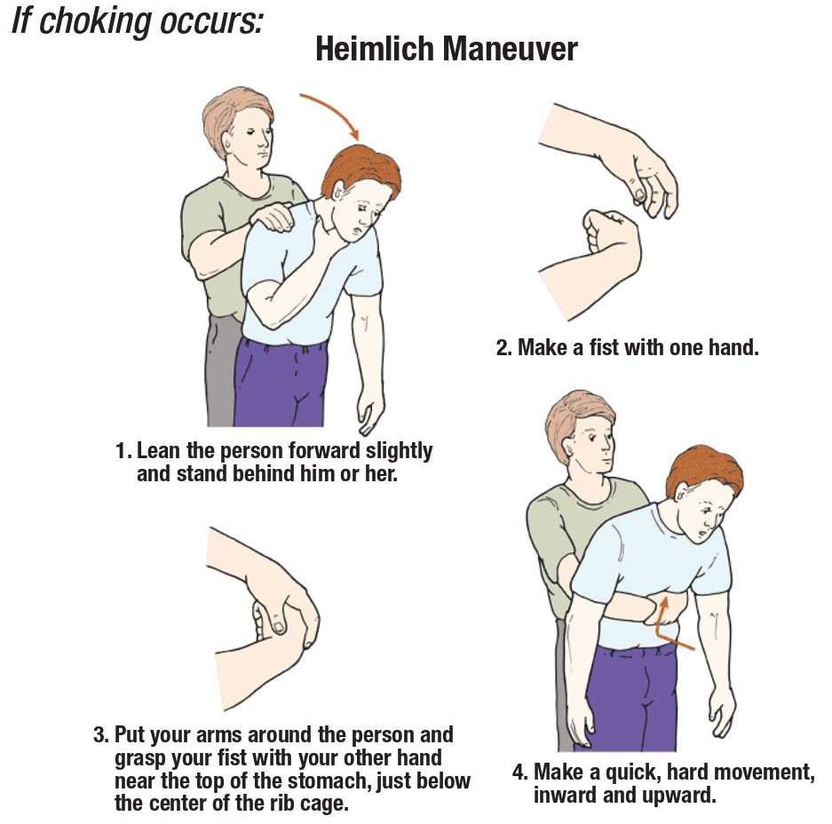 New Heimlich image.jpg